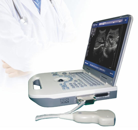 Oriel Notebook Ultrasound Machine - Portable Ultrasound Machine Oriel Notebook Price in Pakistan