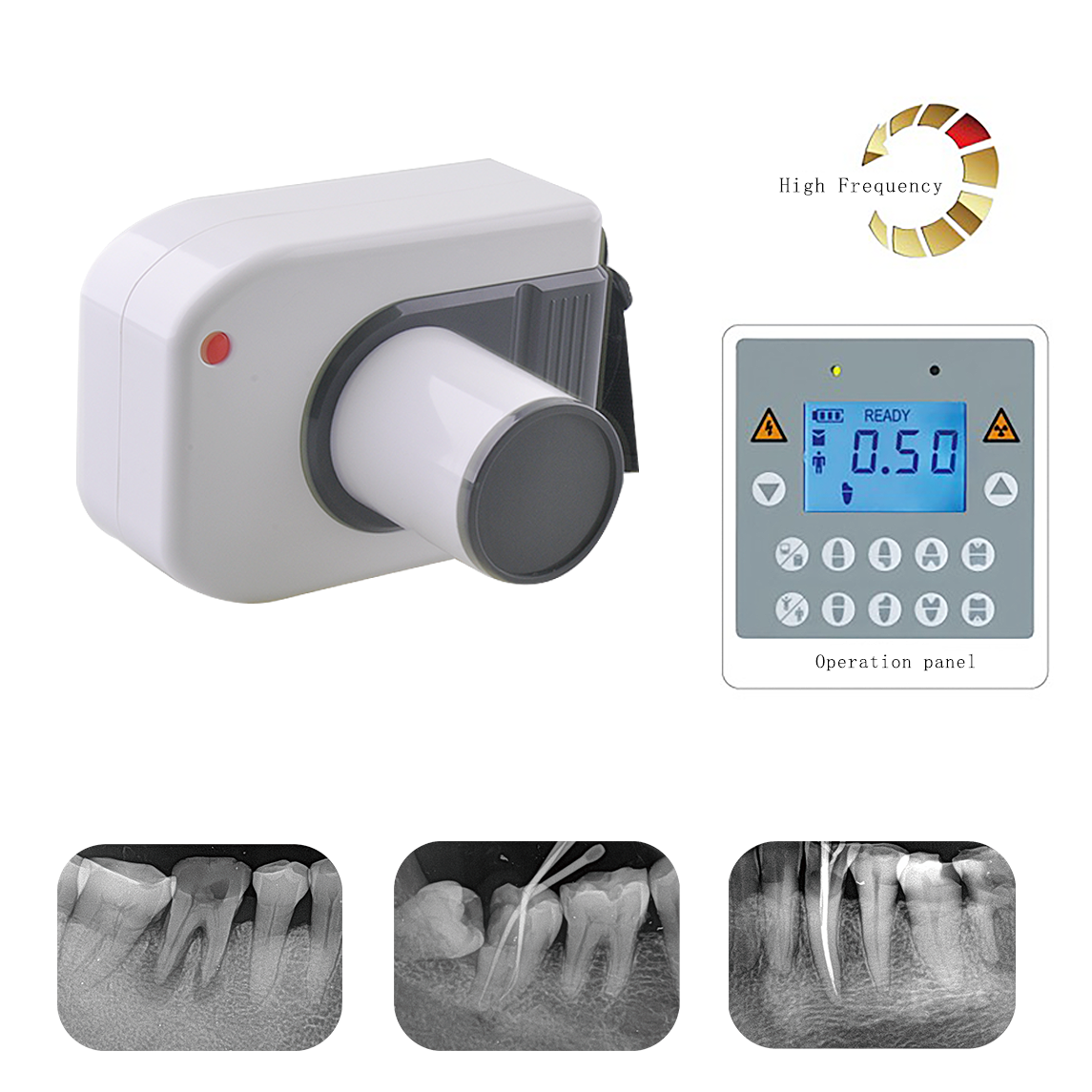 Dental Portable XRay JYF10P High Frequency DC Portable Dental Xra