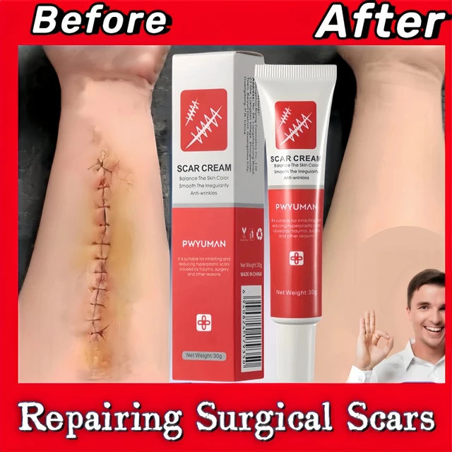 Effective Scar Removal Cream - Treatment Stretch Marks Burn Surgical Scar Ointment Acne Spot Repair Gel - Whitening Smooth Skin Care - Effective Scar Removal Cream Price in Pakistan