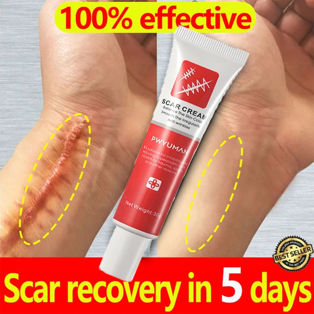 Effective Scar Removal Cream - Treatment Stretch Marks Burn Surgical Scar Ointment Acne Spot Repair Gel - Whitening Smooth Skin Care - Effective Scar Removal Cream Price in Pakistan
