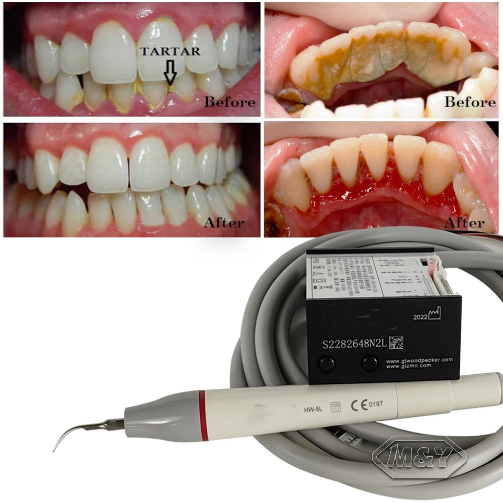 Dental Built in Ultrasonic Scaler HW-3H/5L - N2/N2LED W**dpecker Scali ...