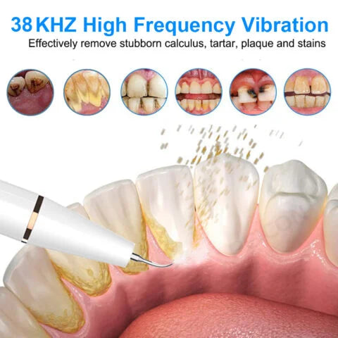 Ultrasonic Dental Tartar Remover Electric Ultra Sonic - Dental Calculus Remover Plaque Removal - Dental Scaler Tartar Eliminator - Dental Tartar Remover price in Pakistan