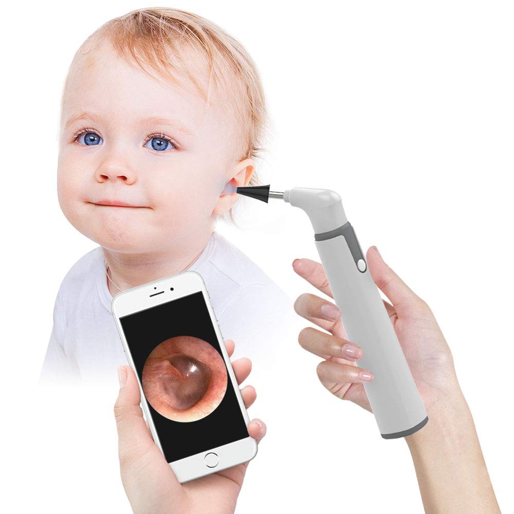 Ear Camerar Wireless Otoscope Ear Camera Price in Pakistan – BRIGHT WAY - 1st ...