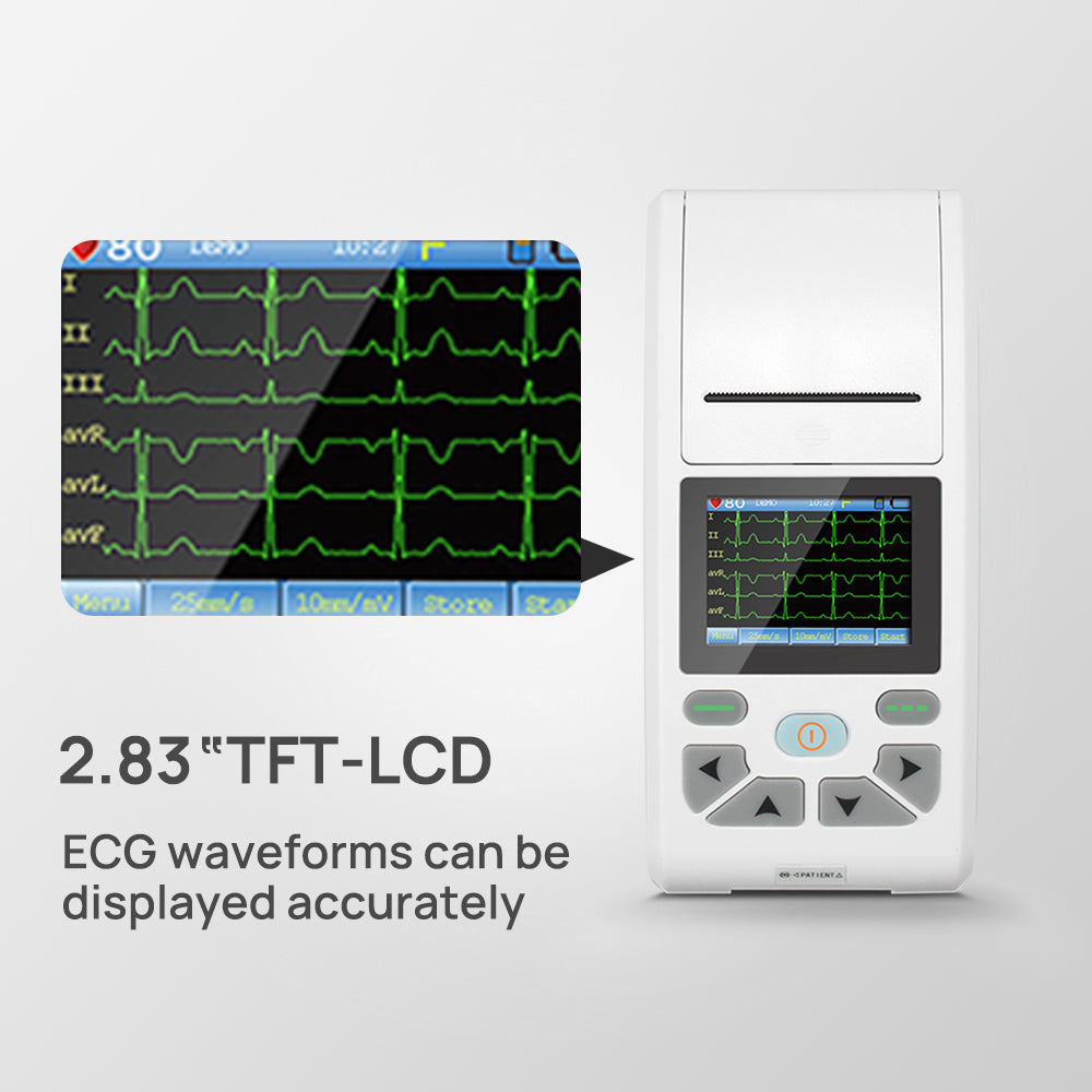 CONTEC ECG90A Digital 12 channel ECG/EKG Machine Electrocardiograph US ...