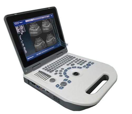 NYRO 10 Portable Ultrasound Machine – Novadex Nyro 10 – Novadex Nyro 10 - Laptop Type Battery Operated Ultrasound Machine - Ultrasound Machine Prices in Pakistan