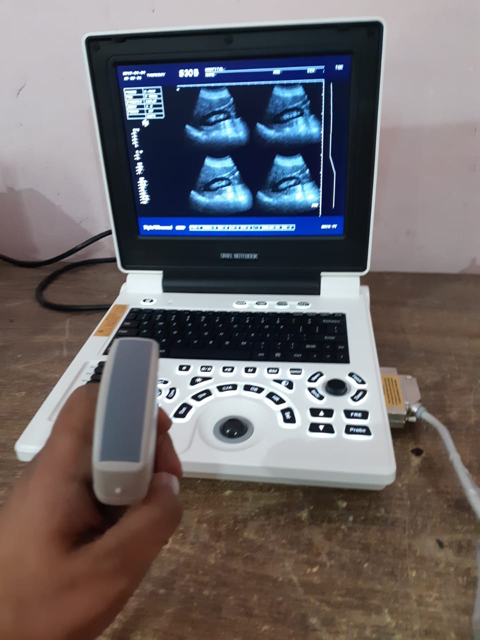 Oriel Notebook Ultrasound Machine - Portable Ultrasound Machine Oriel Notebook Price in Pakistan